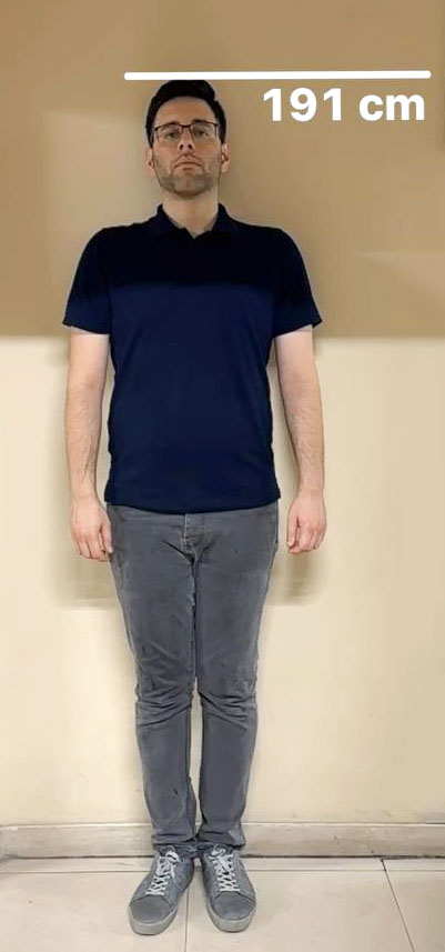 اپ Measure در آیفون