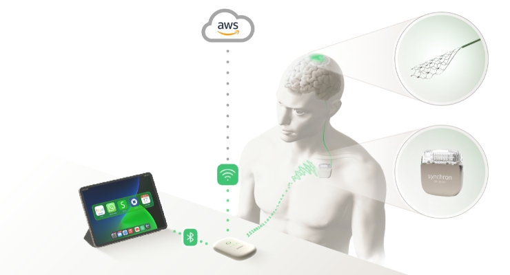 نحوه عملکرد ایمپلنت سینکرون با محصولات اپل برای کنترل آیفون با ذهن